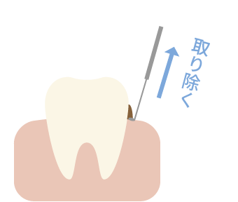 スケーリング イメージ